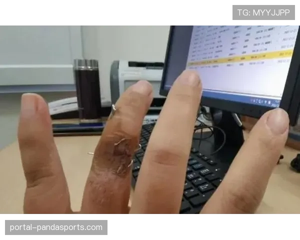 山东外援克里斯手指骨裂预计缺席三周,四月下旬有望复出 山东外援克里斯手指骨裂预计缺席三周,四月下旬有望复出